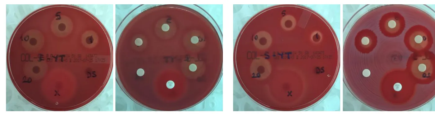 Yüzey temizleyici numunesinin E. coli ve S. aureus petri sonuçları